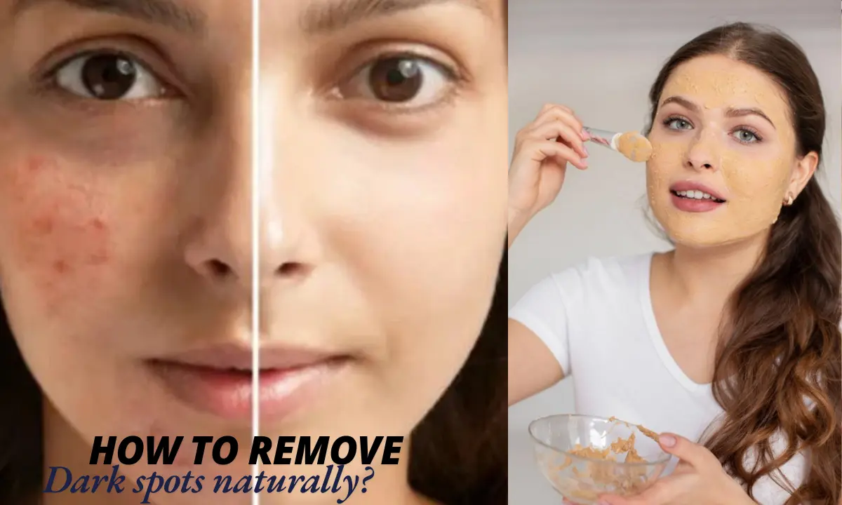 How to reduce dark spots naturally